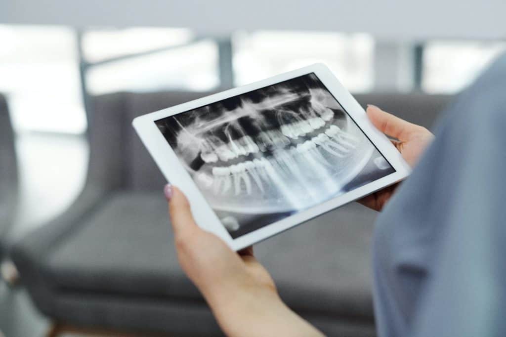 How Much Radiation Is In Dental XRays? Oral Health Columbiana